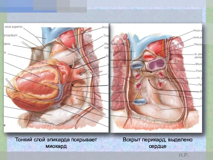 Вскрыт перикард, выделено сердце Тонкий слой эпикарда покрывает миокард