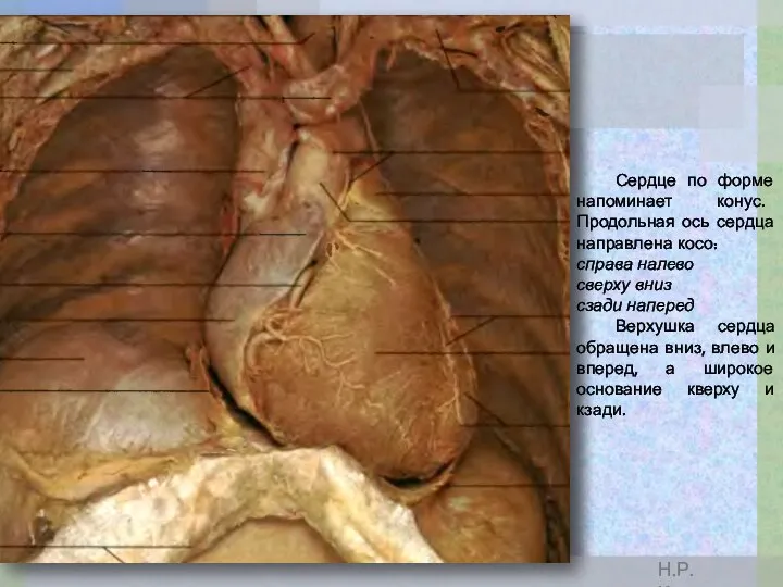 Сердце по форме напоминает конус. Продольная ось сердца направлена косо: справа налево