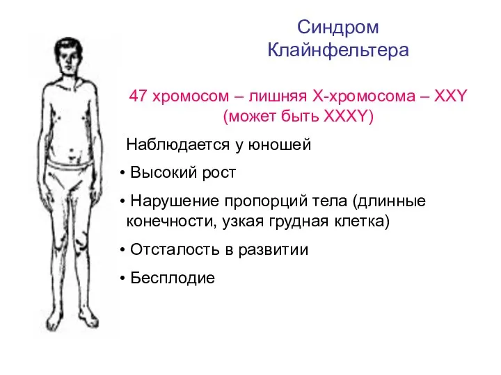 Синдром Клайнфельтера 47 хромосом – лишняя Х-хромосома – ХХY (может быть ХХХY)