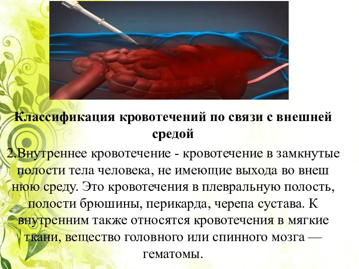 Классификация кровотечений по связи с внешней средой 2.Внутреннее кровотечение - кровотече­ние в