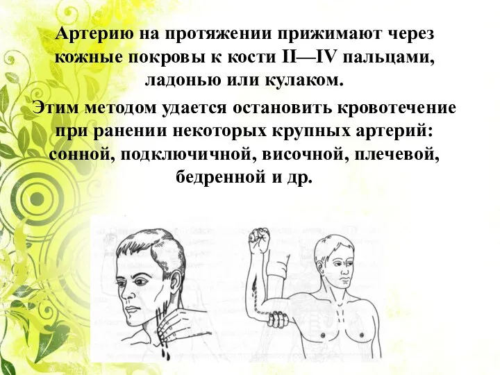 Артерию на протяжении прижимают через кожные покровы к кости II—IV пальцами, ладонью