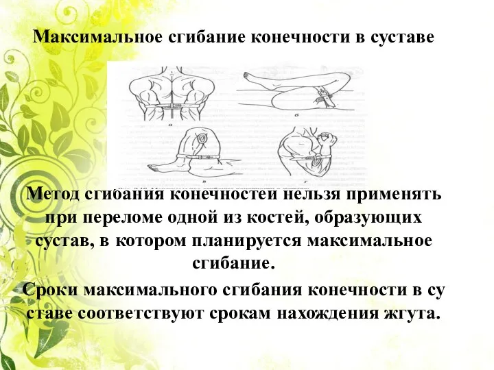 Максимальное сгибание конечности в суставе Метод сгибания конечностей нельзя применять при переломе