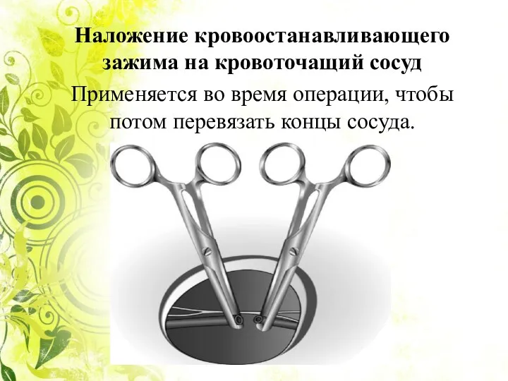 Наложение кровоостанавливающего зажима на кровоточащий сосуд Применяется во время операции, чтобы потом перевязать концы сосуда.