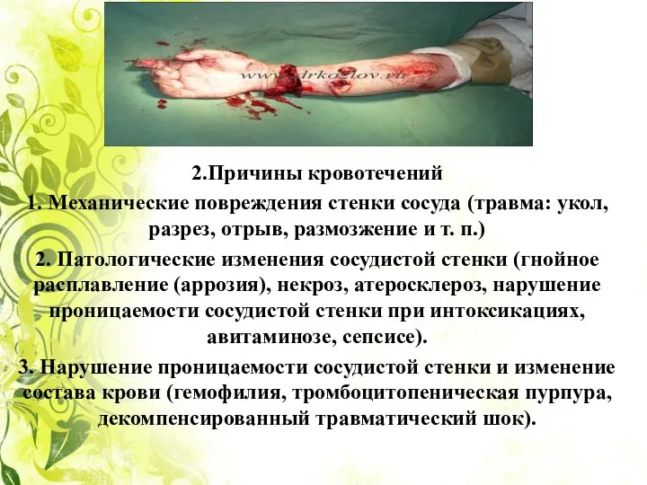 2.Причины кровотечений 1. Механические повреждения стенки сосуда (травма: укол, разрез, отрыв, размозжение