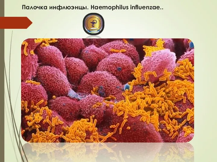 Палочка инфлюэнцы. Haemophilus influenzae..