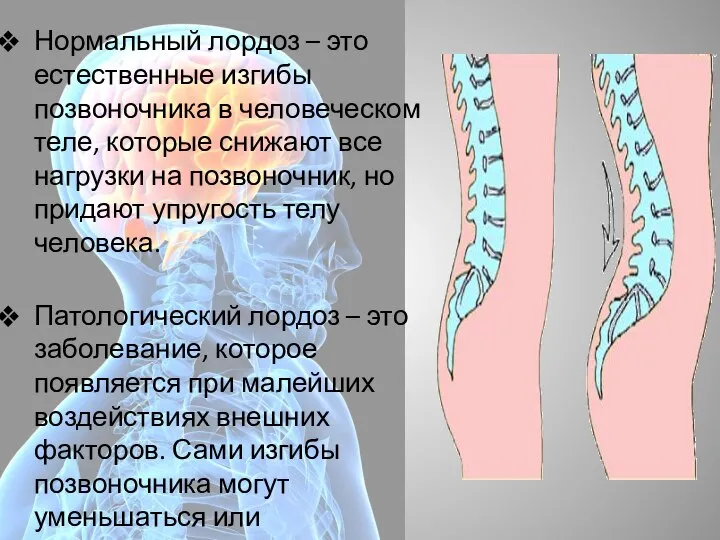 Нормальный лордоз – это естественные изгибы позвоночника в человеческом теле, которые снижают