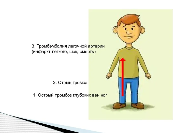 1. Острый тромбоз глубоких вен ног 2. Отрыв тромба 3. Тромбэмболия легочной