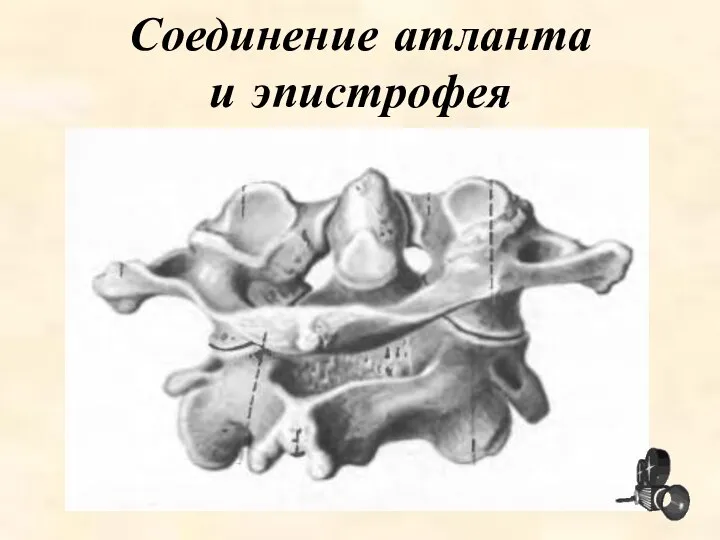 Соединение атланта и эпистрофея