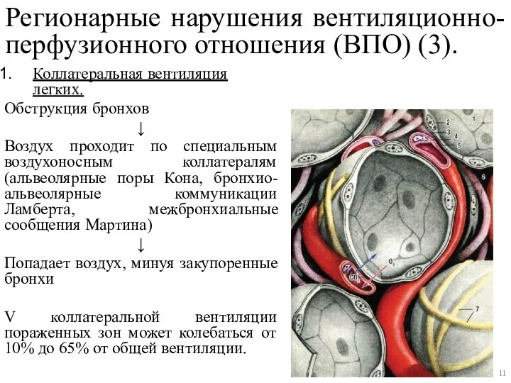 Коллатеральная вентиляция легких. Обструкция бронхов ↓ Воздух проходит по специальным воздухоносным коллатералям