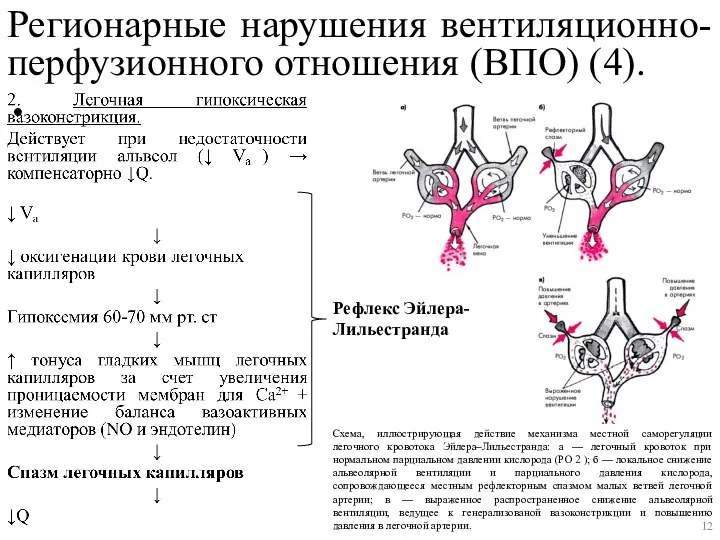 Регионарные нарушения вентиляционно-перфузионного отношения (ВПО) (4). Рефлекс Эйлера-Лильестранда Схема, иллюстрирующая действие механизма