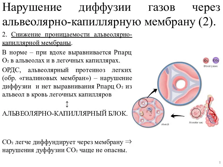 Нарушение диффузии газов через альвеолярно-капиллярную мембрану (2). 2. Снижение проницаемости альвеолярно-капиллярной мембраны.