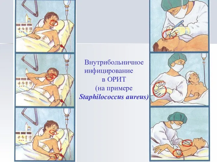 Внутрибольничное инфицирование в ОРИТ (на примере Staphilococcus aureus)