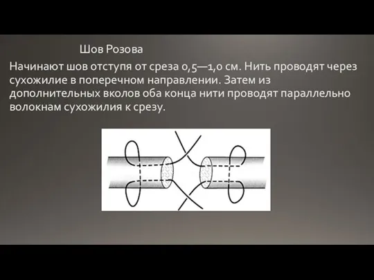 Шов Розова Начинают шов отступя от среза 0,5—1,0 см. Нить проводят через