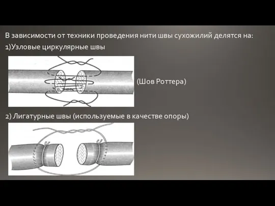 В зависимости от техники проведения нити швы сухожилий делятся на: 1)Узловые циркулярные