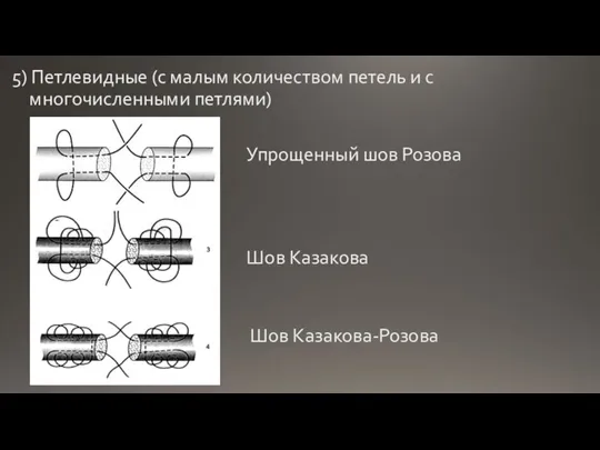 5) Петлевидные (с малым количеством петель и с многочисленными петлями) Упрощенный шов