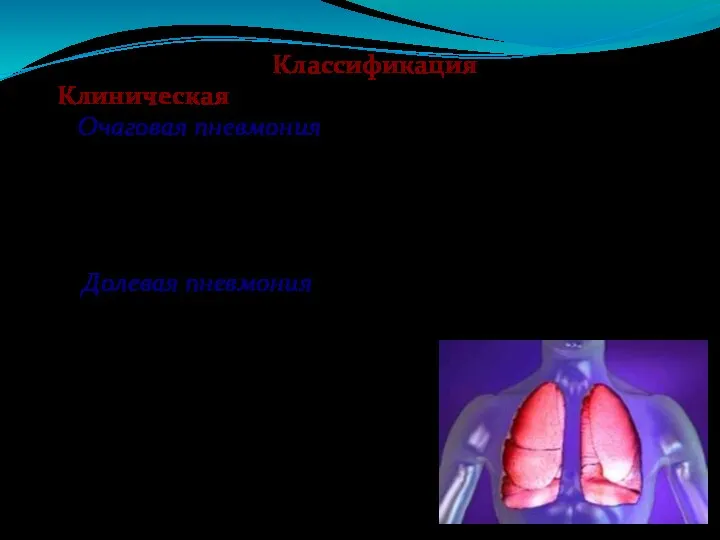 Классификация Клиническая 1. Очаговая пневмония-воспалительный процесс захватывает отдельные участки легочной ткани-альвеолы и