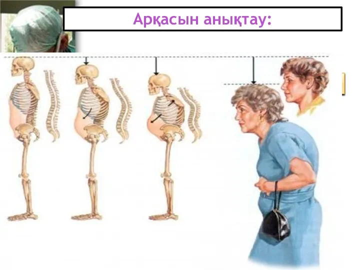 Арқасын анықтау: