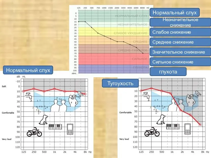 Нормальный слух Незначительное снижение Слабое снижение Среднее снижение Значительное снижение Сильное снижение глухота Нормальный слух Тугоухость