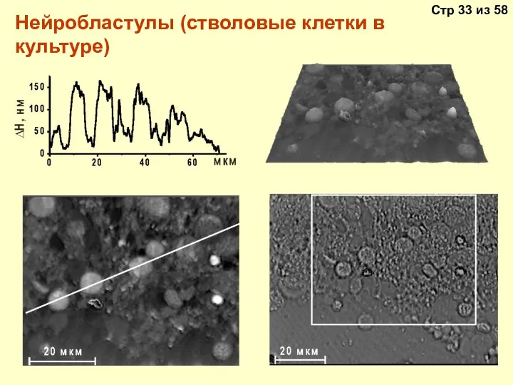 Нейробластулы (стволовые клетки в культуре)