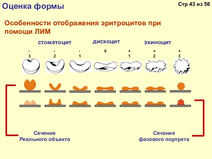 Особенности отображения эритроцитов при помощи ЛИМ Сечение Реального объекта Сечение фазового портрета