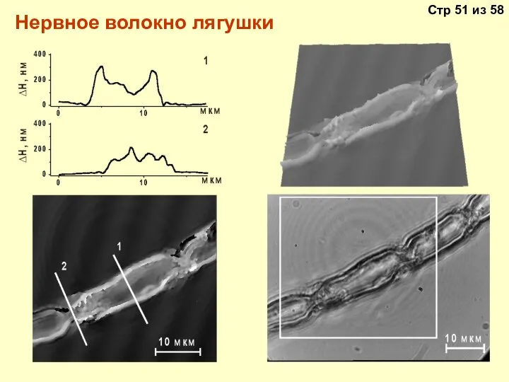 Нервное волокно лягушки