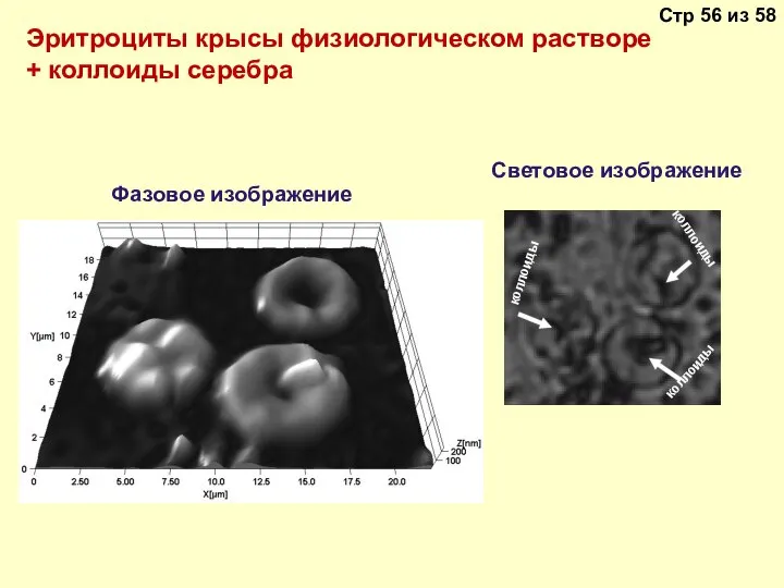 Эритроциты крысы физиологическом растворе + коллоиды серебра Фазовое изображение Световое изображение коллоиды коллоиды коллоиды