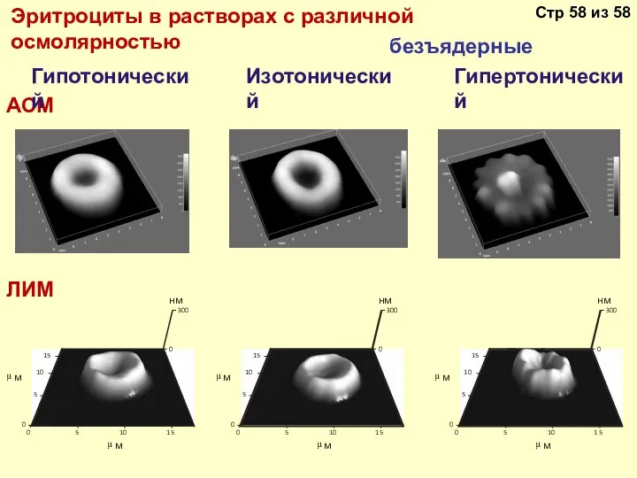 Эритроциты в растворах с различной осмолярностью безъядерные АСМ Гипотонический Изотонический Гипертонический ЛИМ