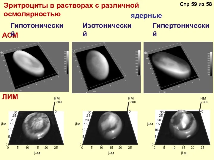 Эритроциты в растворах с различной осмолярностью ядерные АСМ Гипотонический Изотонический Гипертонический ЛИМ