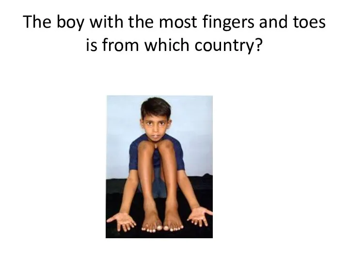 The boy with the most fingers and toes is from which country?