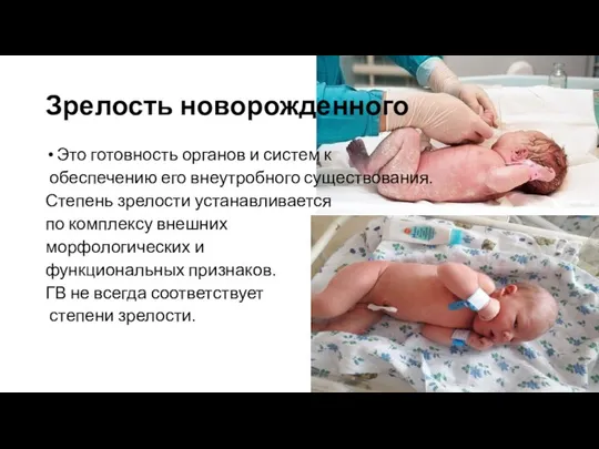 Зрелость новорожденного Это готовность органов и систем к обеспечению его внеутробного существования.