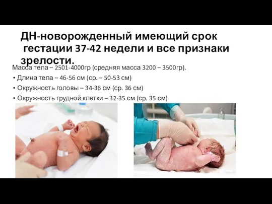 ДН-новорожденный имеющий срок гестации 37-42 недели и все признаки зрелости. Масса тела