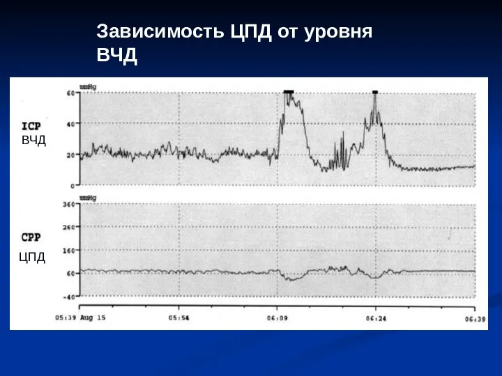 Зависимость ЦПД от уровня ВЧД ВЧД ЦПД