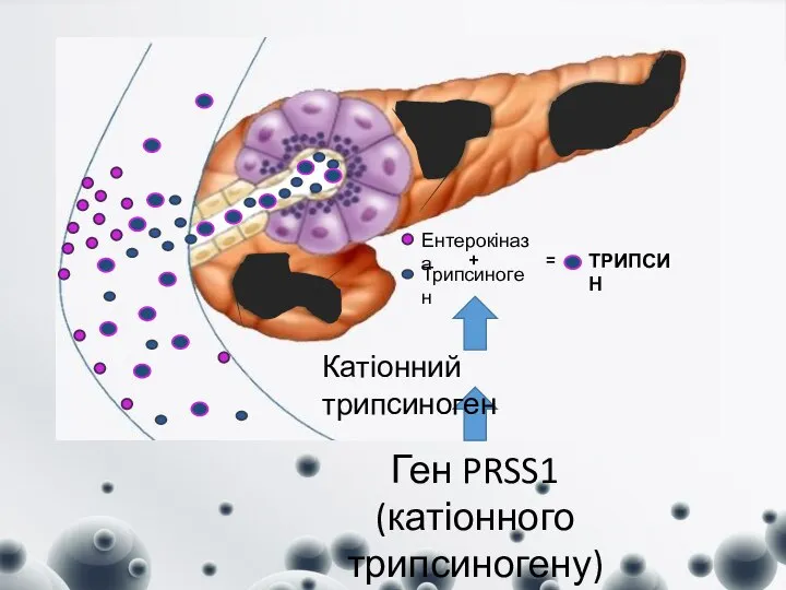 Ген PRSS1 (катіонного трипсиногену) Катіонний трипсиноген Трипсиноген Ентерокіназа + = ТРИПСИН
