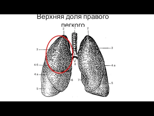 Верхняя доля правого легкого