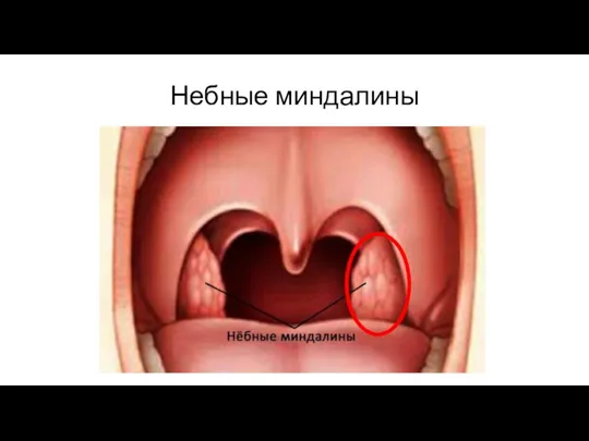 Небные миндалины