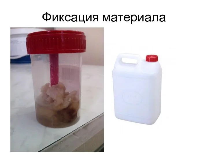 Фиксация материала