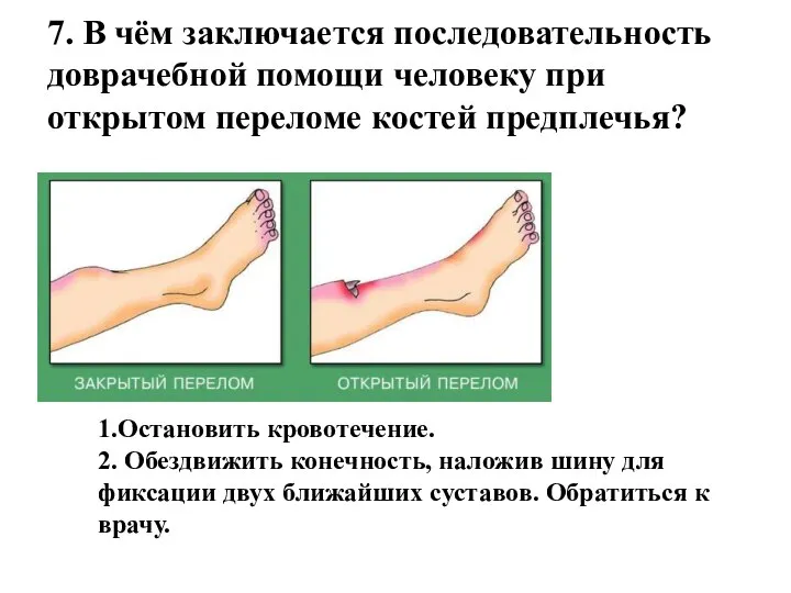 7. В чём заключается последовательность доврачебной помощи человеку при открытом переломе костей