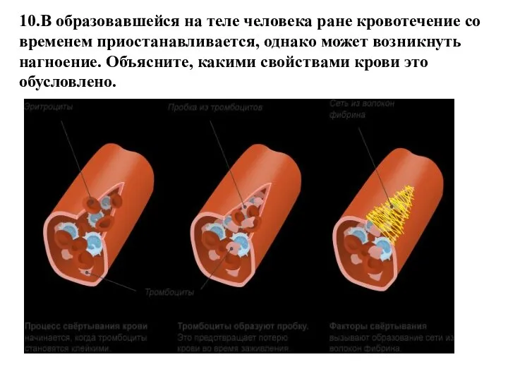 10.В образовавшейся на теле человека ране кровотечение со временем приостанавливается, однако может