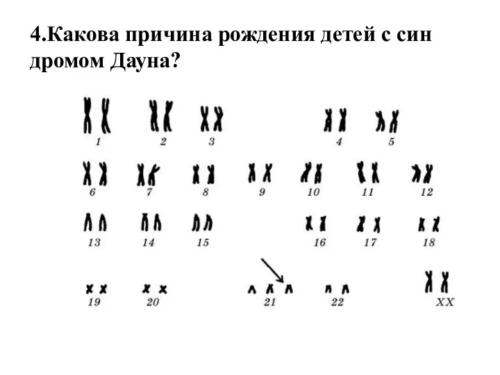 4.Какова при­чи­на рож­де­ния детей с син­дро­мом Дауна?