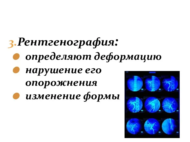 3.Рентгенография: определяют деформацию нарушение его опорожнения изменение формы