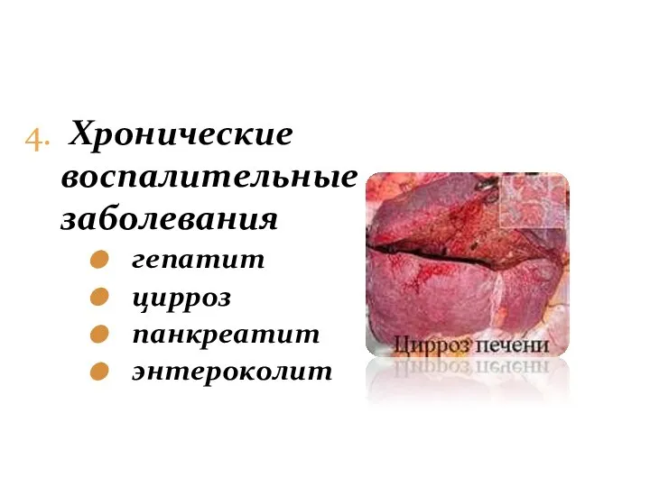 4. Хронические воспалительные заболевания гепатит цирроз панкреатит энтероколит