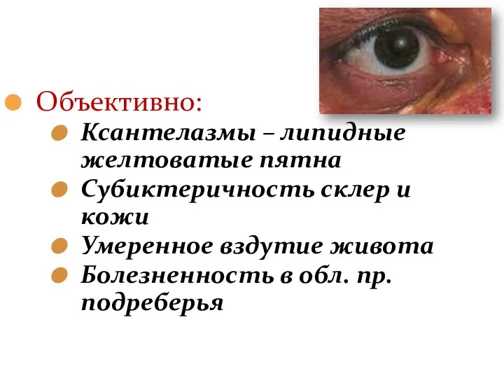 Объективно: Ксантелазмы – липидные желтоватые пятна Субиктеричность склер и кожи Умеренное вздутие