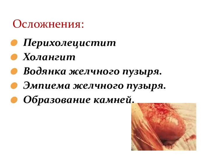 Перихолецистит Холангит Водянка желчного пузыря. Эмпиема желчного пузыря. Образование камней. Осложнения: