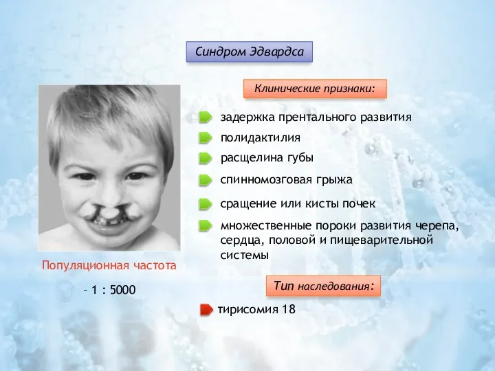 Клинические признаки: задержка прентального развития множественные пороки развития черепа, сердца, половой и