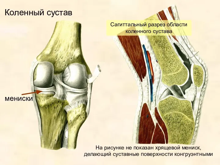 Коленный сустав мениски Сагиттальный разрез области коленного сустава На рисунке не показан