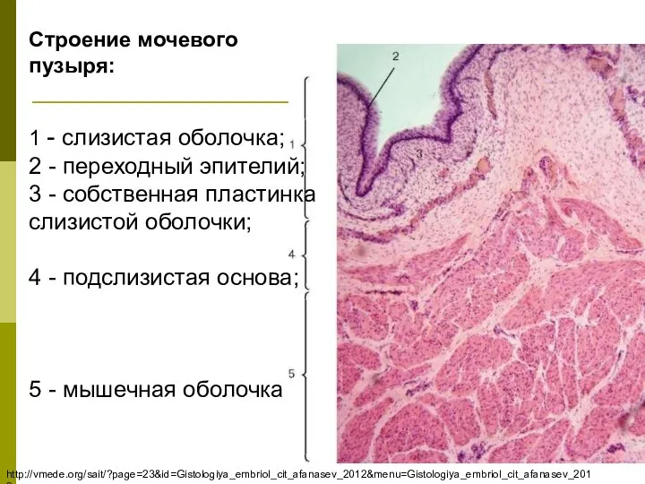 1 - слизистая оболочка; 2 - переходный эпителий; 3 - собственная пластинка