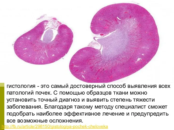 http://fb.ru/article/298150/gistologiya-pochek-cheloveka гистология - это самый достоверный способ выявления всех патологий почек. С