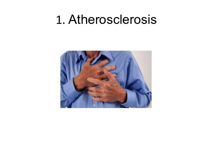 1. Atherosclerosis