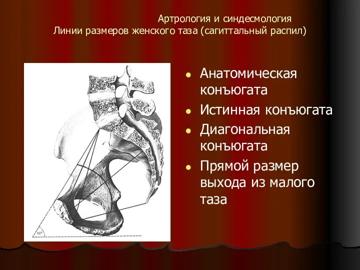 Артрология и синдесмология Линии размеров женского таза (сагиттальный распил) Анатомическая конъюгата Истинная