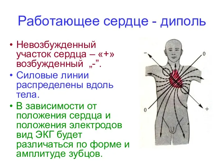 Работающее сердце - диполь Невозбужденный участок сердца – «+» возбужденный „-”. Силовые